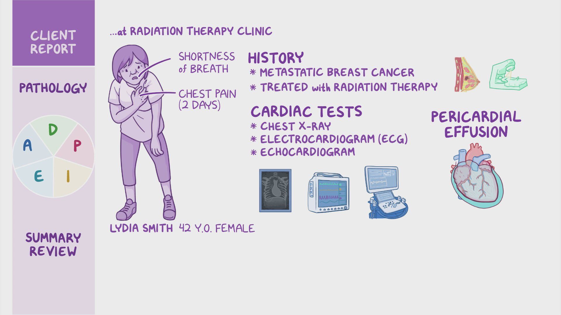 Pericardial effusion & Cardiac tamponade: Nursing Process (ADPIE) - Osmosis