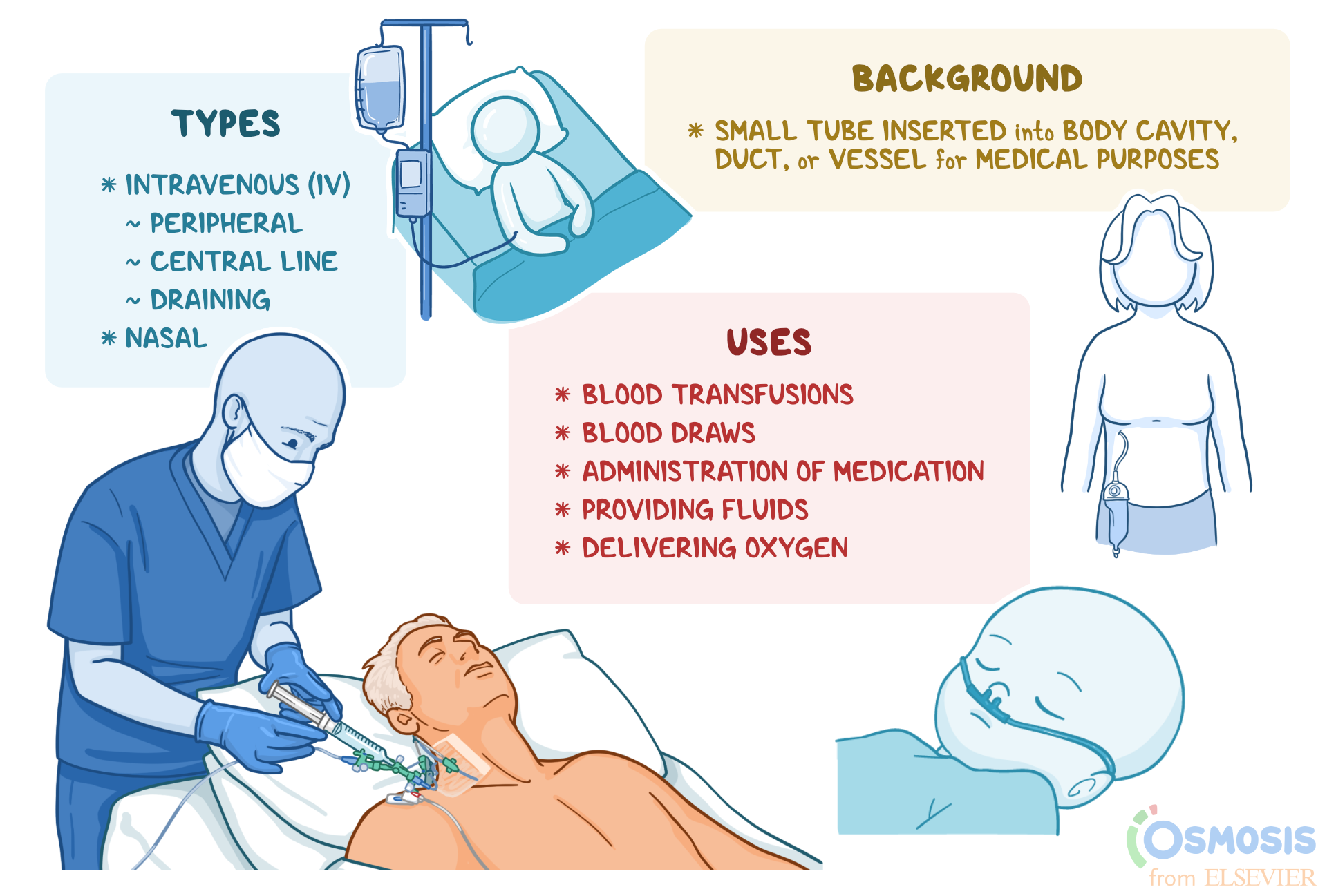 Different Iv Catheter Types | edu.svet.gob.gt