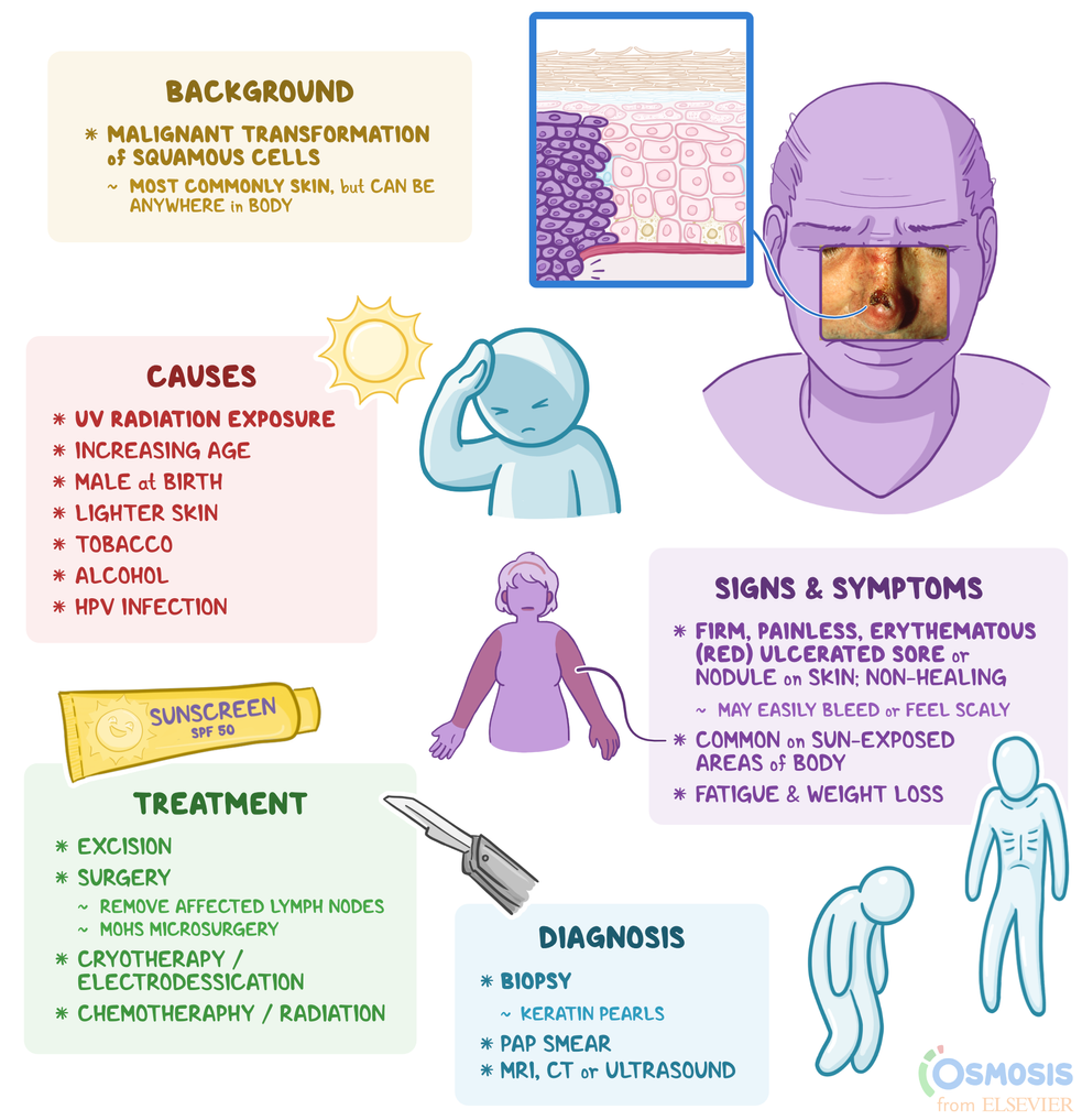 Squamous Cell Carcinoma Skin Cancer Treatment