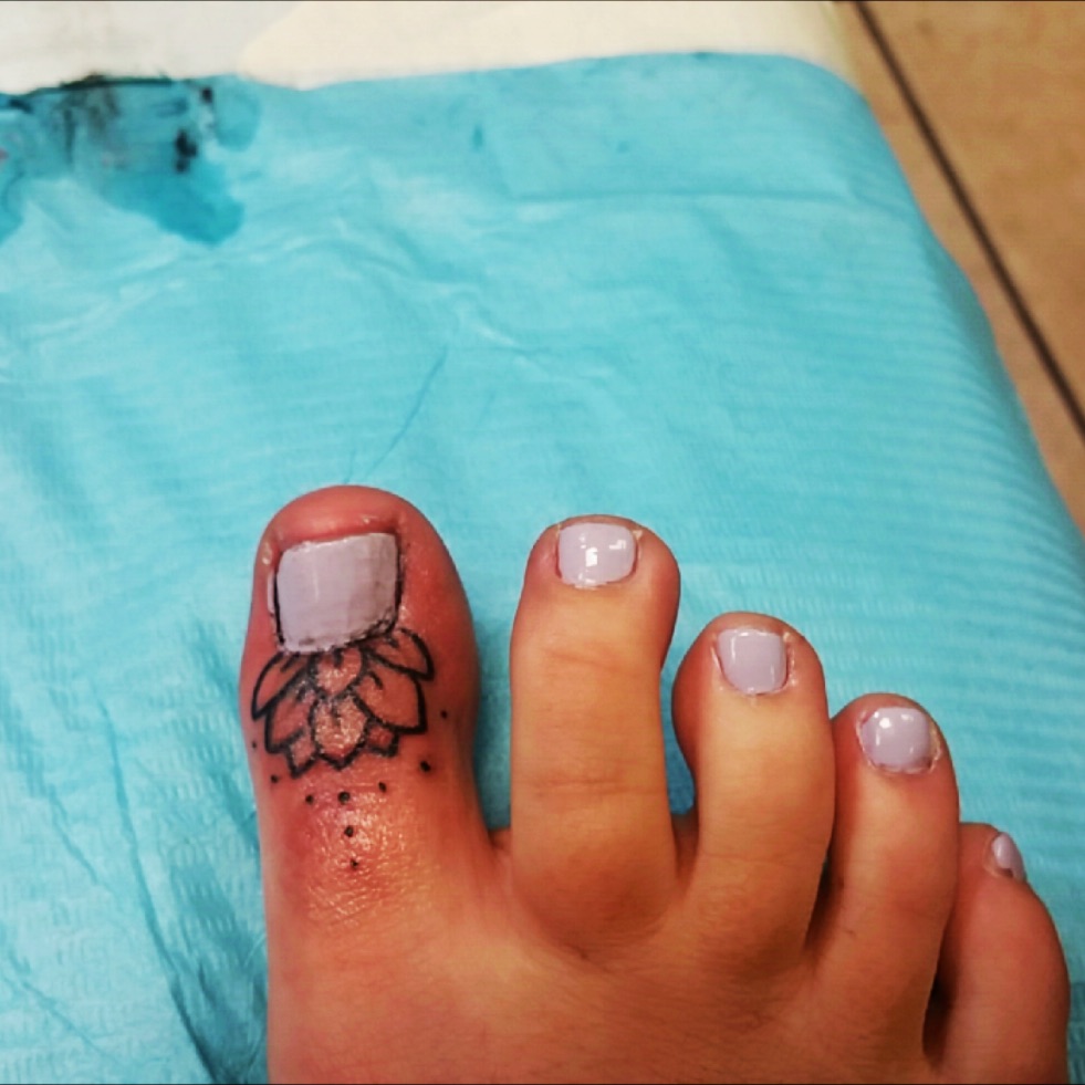 Cinnamon Girl Tattoo  TOE NAIL TATTOO  2 big toe nails lost after  ingrown nails She has not worn open toed shoes since gamechanger Artist  Jody 4032882769 wwwcinnamongirlclinicca  Facebook