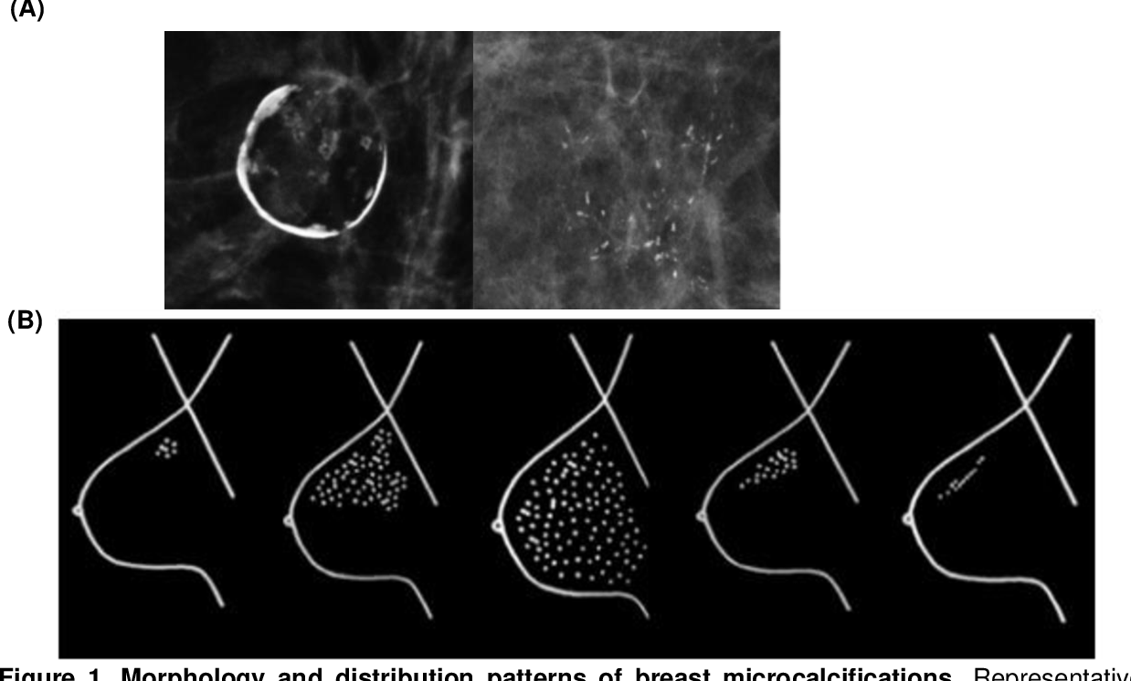 Figure 3 From Classification Of Malignant And Benign - vrogue.co