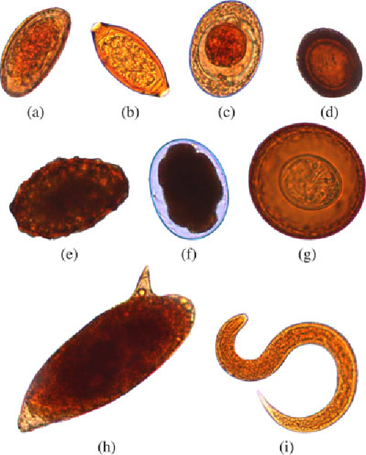 Human Stool Parasites - Claire Trend