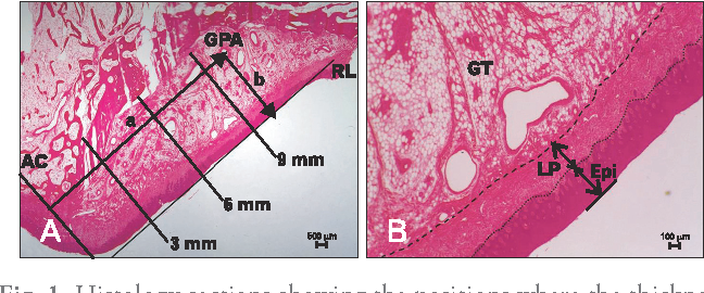 Hard Palate Histology