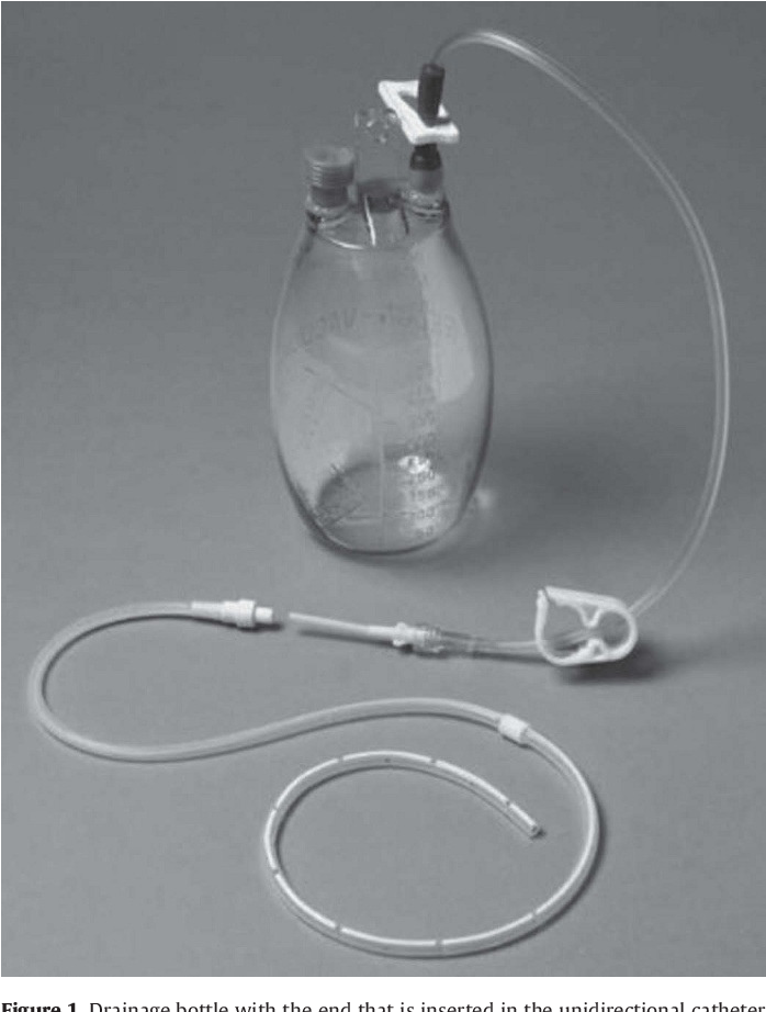 Indwelling Pleural Catheters For Benign Pleural Effusions, 53% OFF