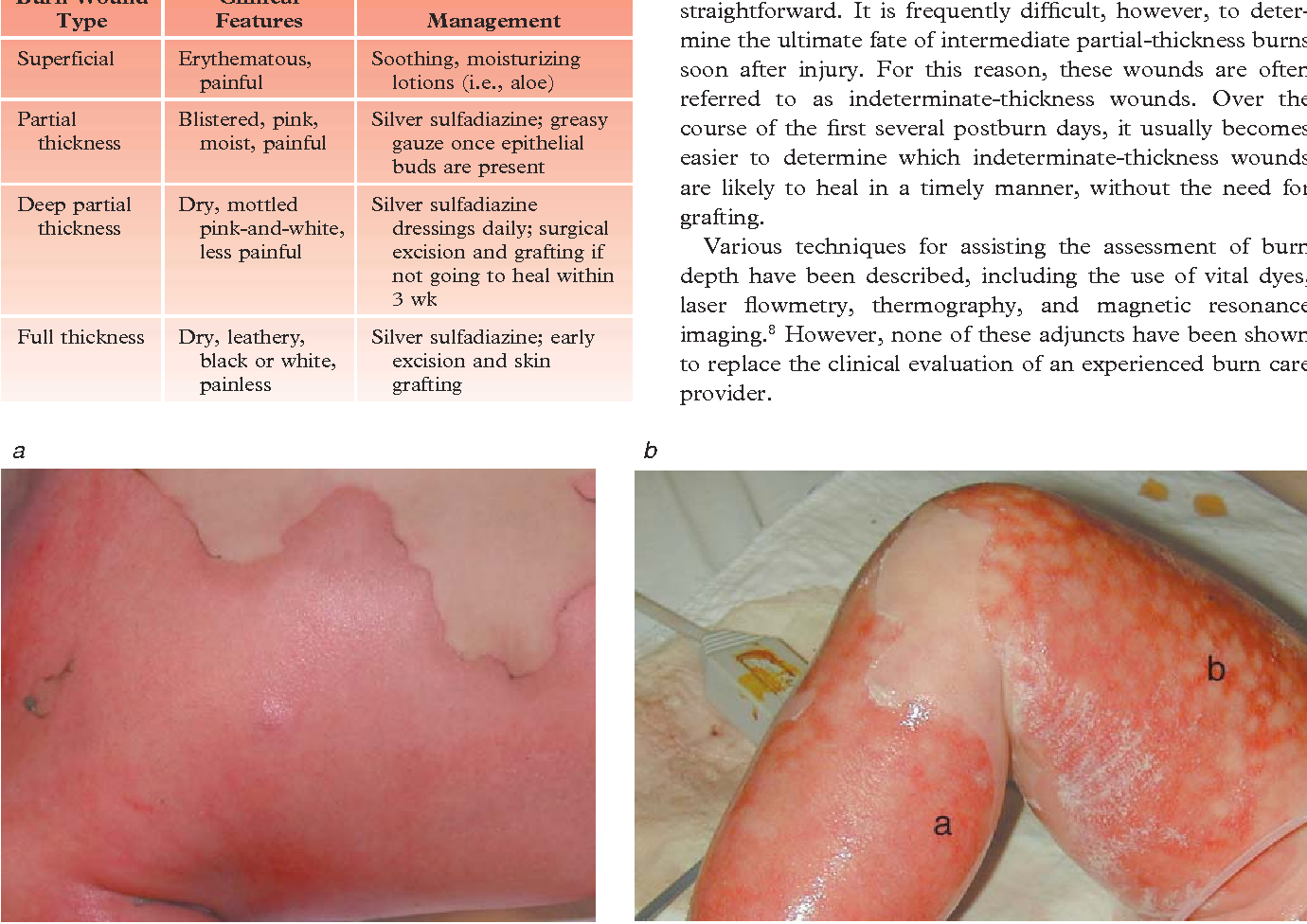 Figure 10 from Management of the burn wound. | Semantic Scholar