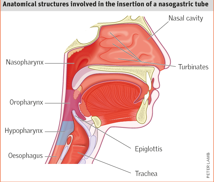 How to insert a nasogastric tube and check gastric position at the ...