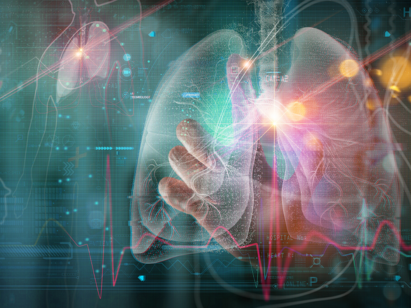 Diagnosis and Classification of Interstitial Lung Disease ...