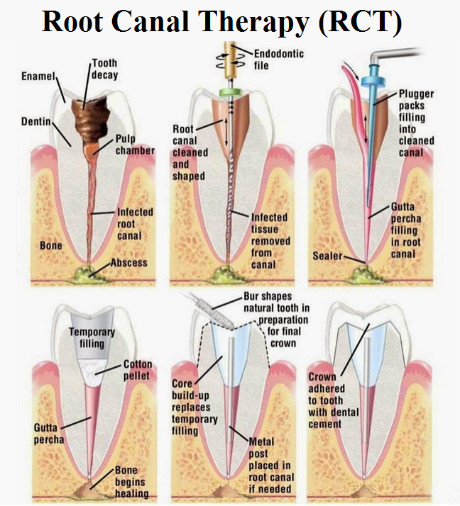 อันดับหนึ่ง 101+ ภาพพื้นหลัง โปรแกรม Root จีน ใหม่ที่สุด