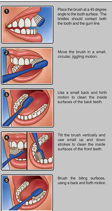 Brushing-instruction-logo2 (2) - Dental Aisle