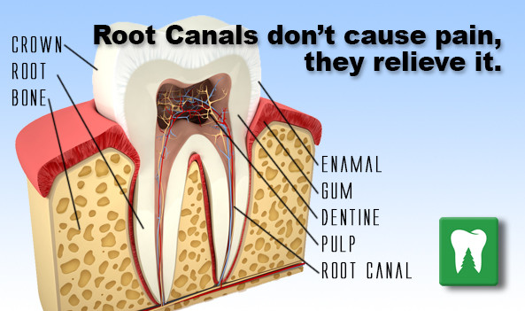 ültetvényes egy kis Kerek pain in root canal tooth years later paszta ...