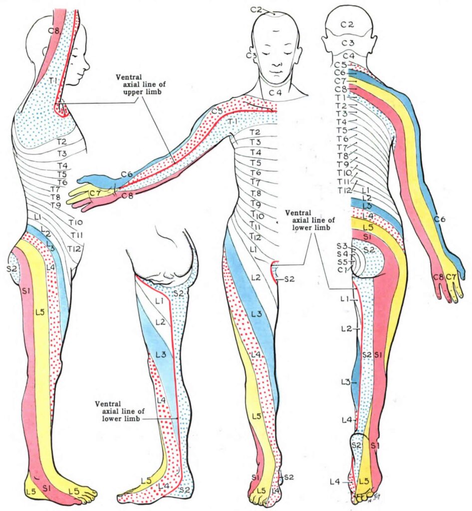 Spinal Anesthesia Dermatome Levels