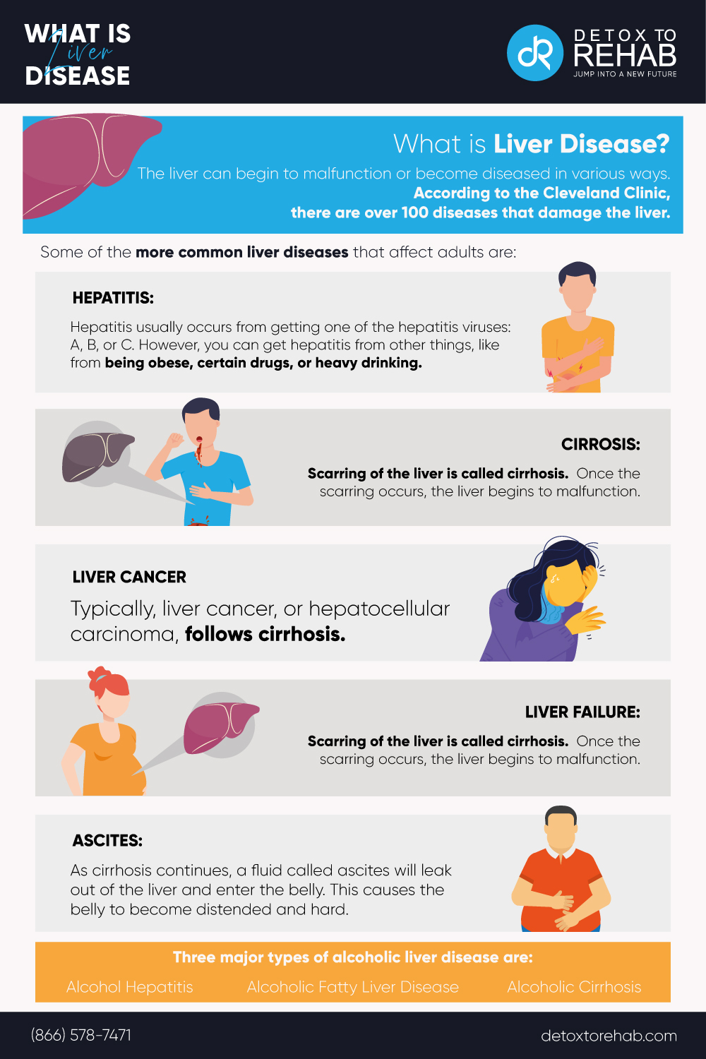 Cirrhosis Symptoms