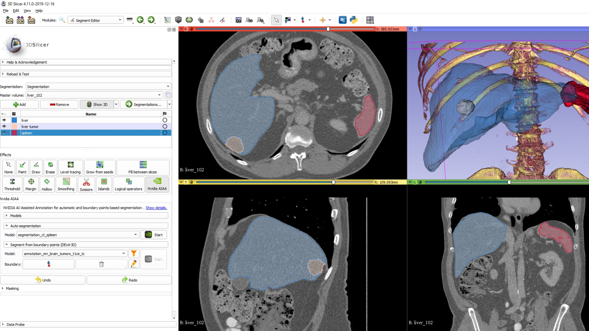 3D Slicer With NVIDIA Holoscan Image credit: OpenIGTLink