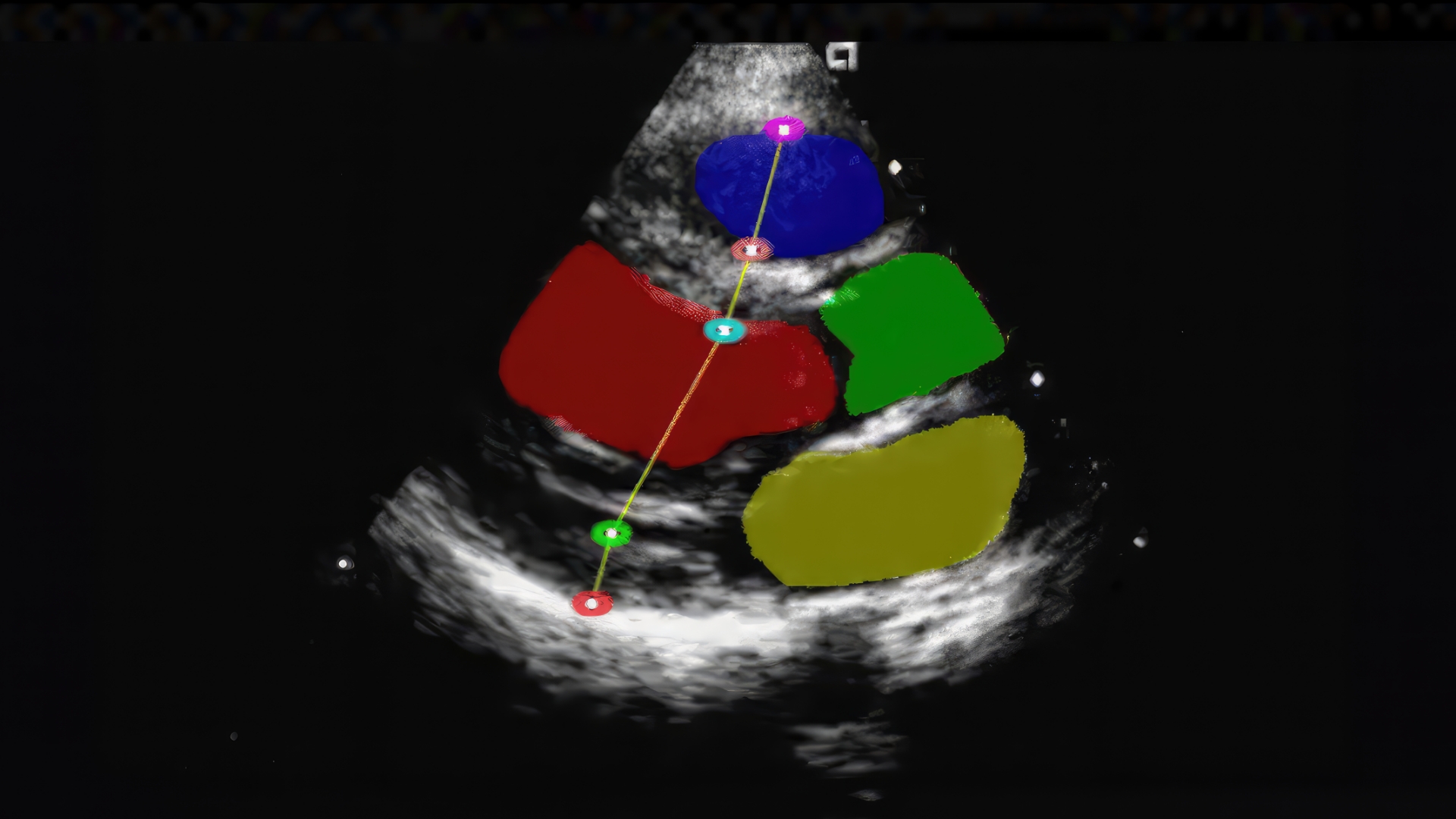 Multi AI Ultrasound Reference Application on GitHub Image credit: iCardio.ai