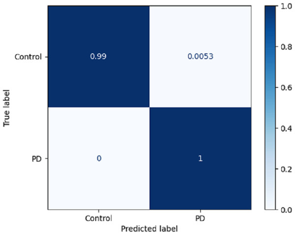 Confusion matrix on DLBLSTM model on Parkinson’s disease detection.