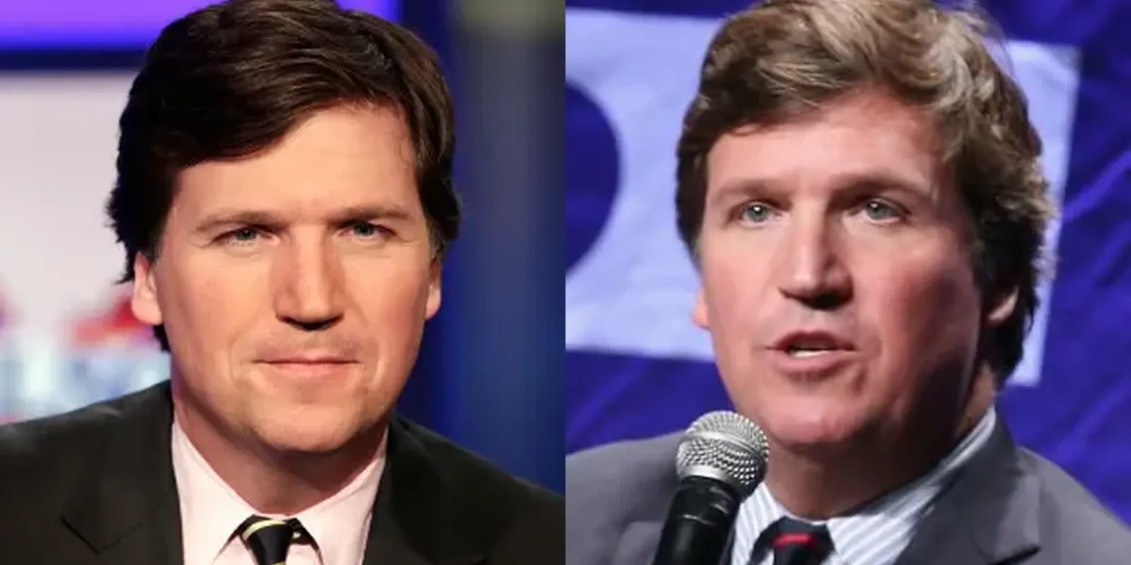 Does Tucker Carlson Wear A Wig 