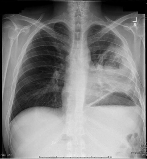 MUCORMYCOSIS – Dr Rajiv Desai