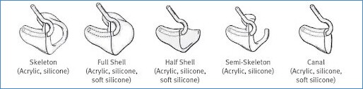 Different Types of Earmolds blog image