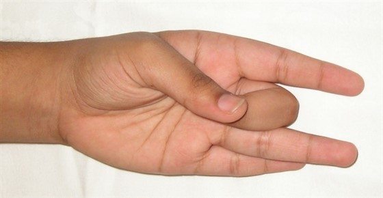 Shunya Mudra Yoga Posture blog image