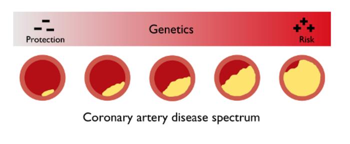 Coronary artery disease spectr [IMAGE] | EurekAlert! Science News Releases