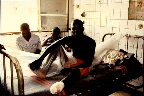 Angola Civil War 1997 Landmine Amputee Redaktionelles Stockfoto ...