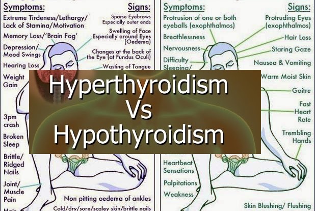 Hyperthyroidism Vs Hypothyroidism Hyperthyroidism And Hypothyroidism