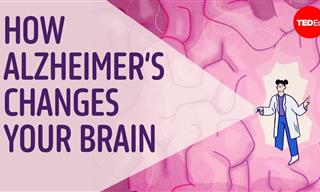 Decoding Alzheimer's: Why is a Cure So Elusive?