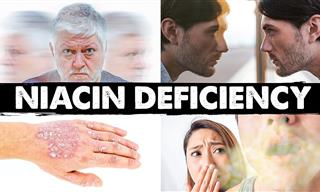 Spot Niacin (Vitamin B3) Deficiency Early with This Guide