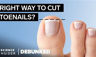 What Really Causes Bunions? - Foot Health Myths Debunked