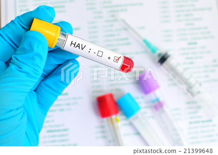 Stock Photo: Hepatitis A virus (HAV) test