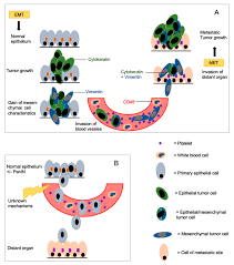 While the regions above are the most common sites for lung cancer metastases, lung cancer has on occasion spread to the stomach, small and large intestines, the pancreas, the eye, the skin, the kidney, and even the. Cancers Free Full Text Circulating Tumor Cells In Pancreatic Cancer Current Perspectives Html