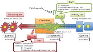 Otto van delden and robin smithuis. Model Of The Functional Roles Of Prrx1a And Prrx1b In Pancreatic Cancer Download Scientific Diagram