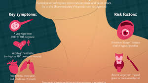 Could you have a thyroid problem? Thyroid Storm Symptoms Causes Diagnosis Treatment