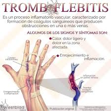 Como se mencionó, existen dos tipos de trombosis en venas: Westblad Medical Tromboflebitis La Tromboflebitis Trombosis Venosa Es Una Inflamacion De Las Venas Asociada Con Trombosis Venosa Tradicionalmente Se Ha Considerado Una Enfermedad Benigna Autolimitada Sin Embargo Puede Afectar A Los