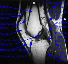 Tendons attach the muscles to each other. Mri Knee Anatomy Anatomy Drawing Diagram