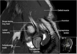 Use the checklist to quiz yourself. The Radiology Assistant Shoulder Anatomy Mri