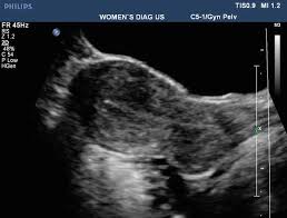 We did not find results for: Ultrasound Imaging Of Gynaecologic Organs Springerlink