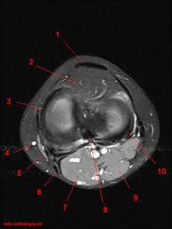 Normal mri anatomy of the knee. Atlas Of Knee Mri Anatomy W Radiology