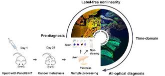 In general, the more the cancer has grown and spread (the more advanced the cancer), the less chance that. Label Free Whole Colony Imaging And Metabolic Analysis Of Metastatic Pancreatic Cancer By An Autoregulating Flexible Optical System Theranostics X Mol