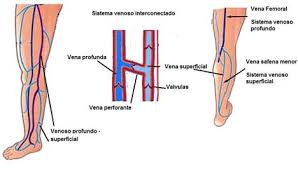 Trombosis venosa superficial definición se define como trombosis venosa superficial (tvs) el procesoque cursa con síntomas de inflamación venosa y trombosis confirmada de las venas y que puede afectar a venas superficiales de cualquier localización: Trombosis Venosa Superficial Tromboflebitis En Mujeres Transexuales Monografias Com