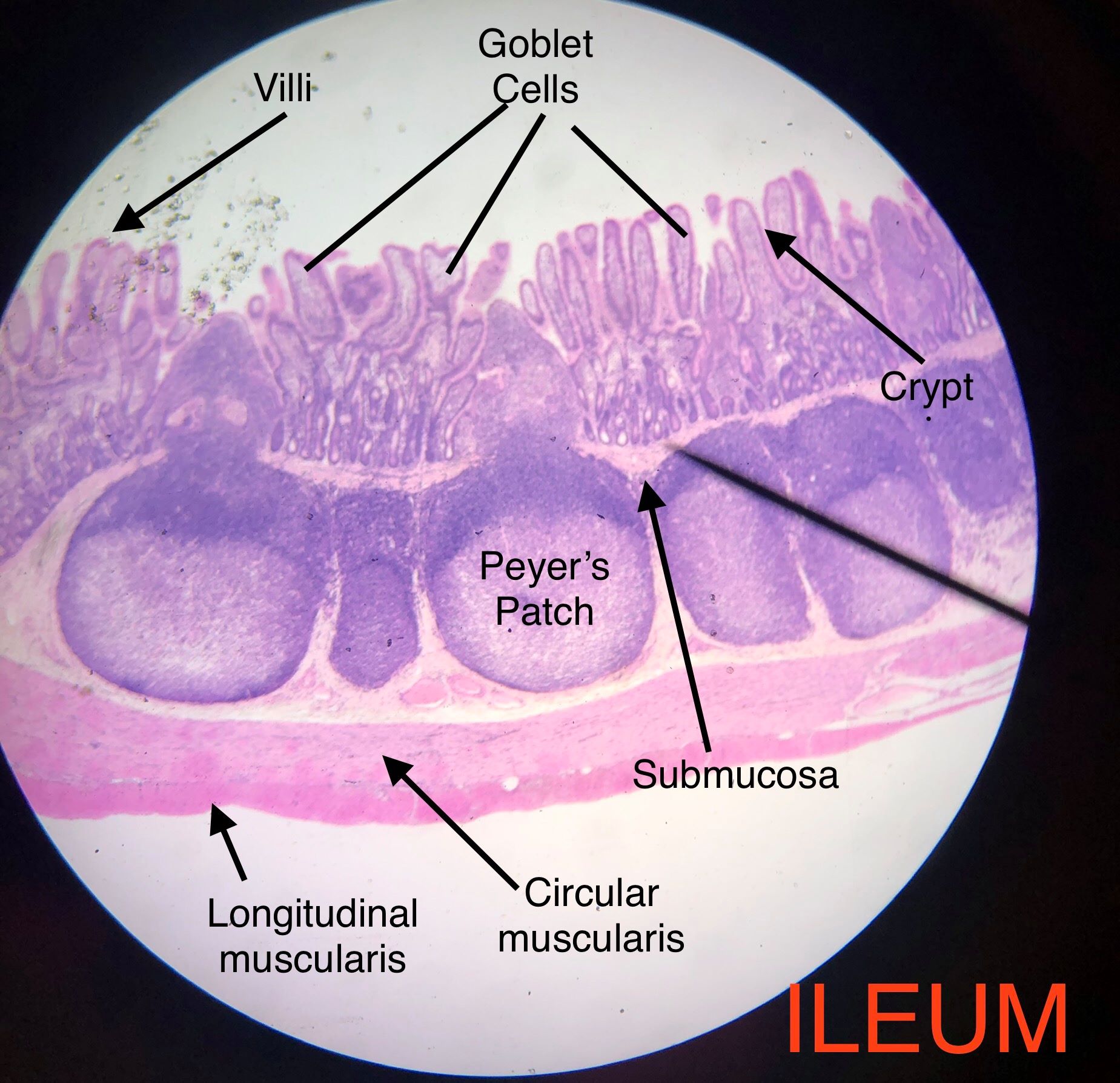 Duodenum Histology Histology Slides Intestines Let It Be Images