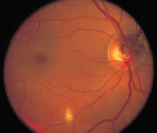 6 Neuro-Ophthalmology | Ento Key