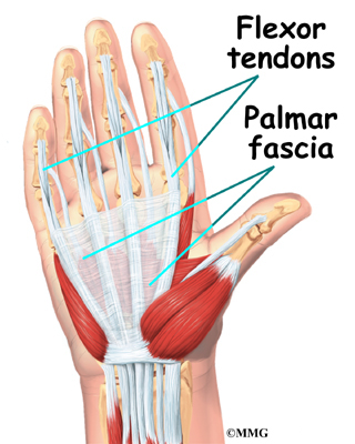 Dupuytren's Contracture - eOrthopod.com