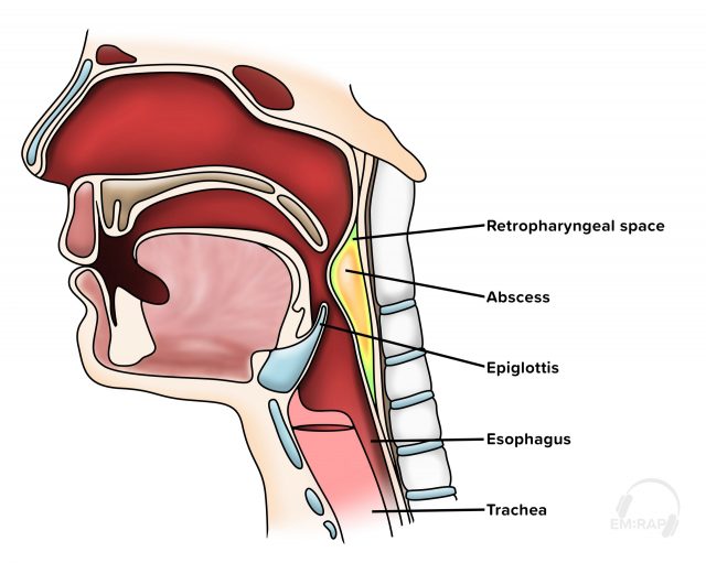 CorePendium: An Emergency Medicine Origin Story | Emergency Physicians ...