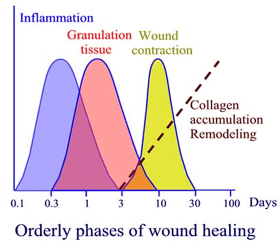 5 Stages Of Wound Healing