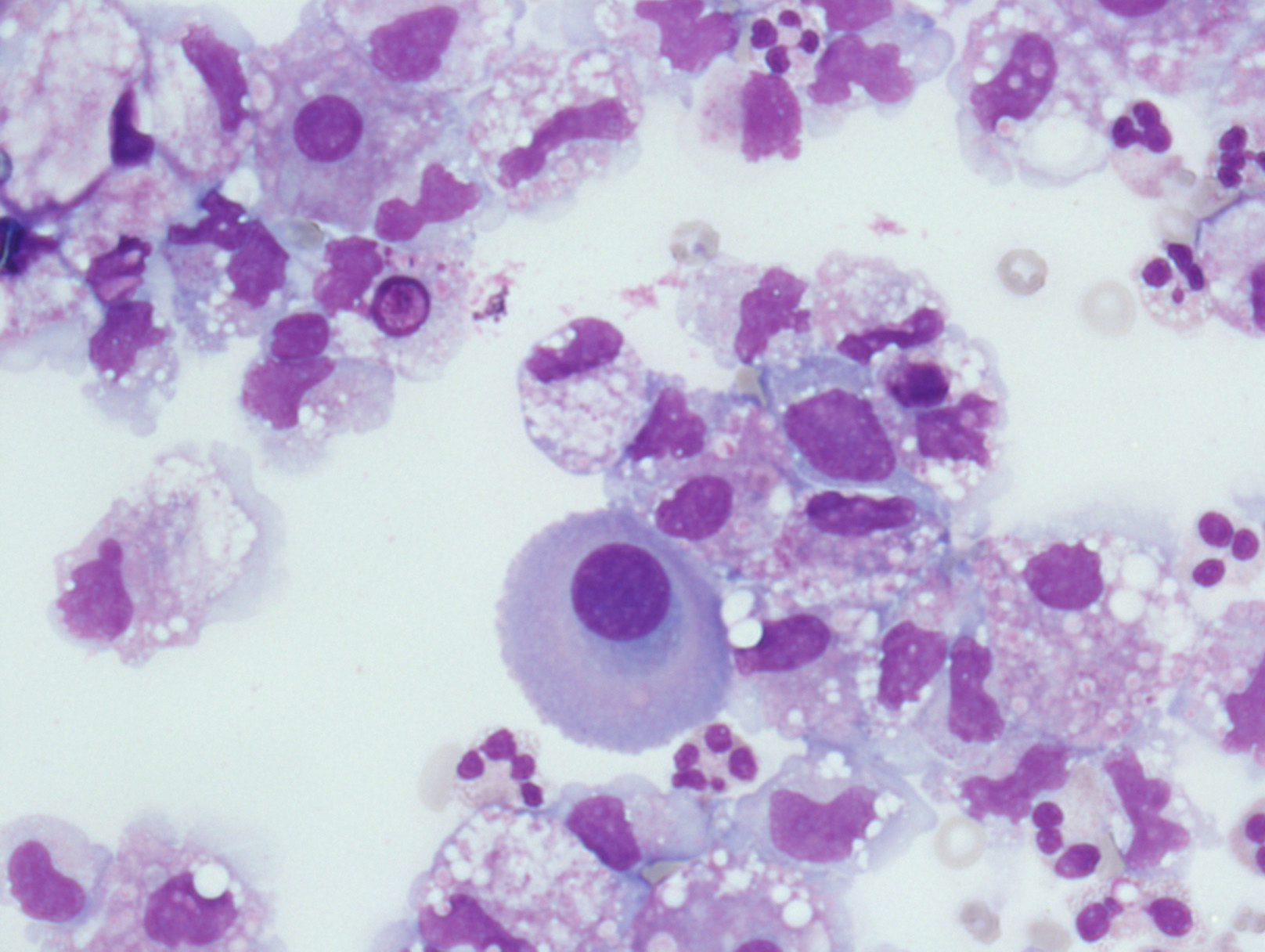 Mesothelial Cells