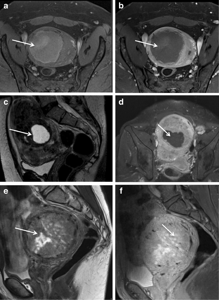 European Society of Urogenital Radiology (ESUR) Guidelines: MR Imaging ...