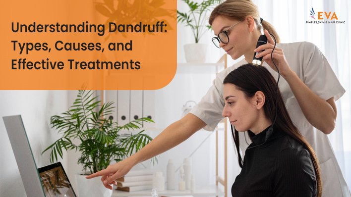 Understanding Dandruff: Types, Causes, and Effective Treatments