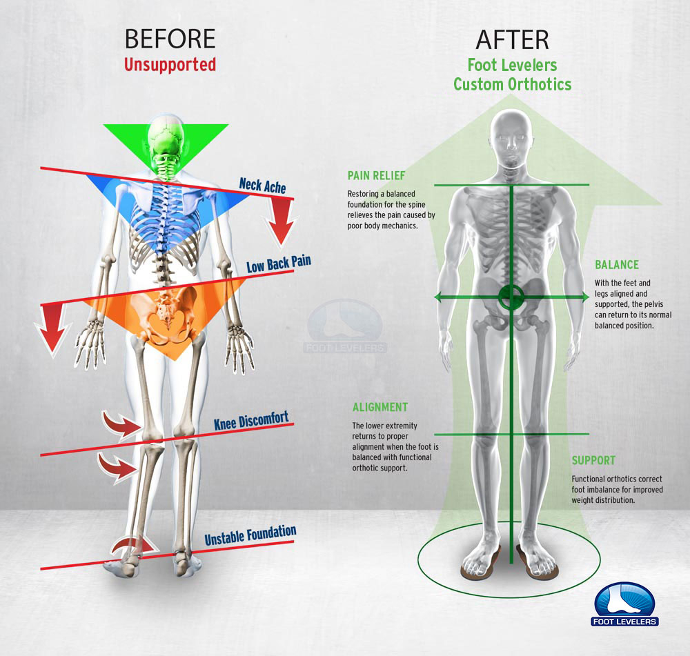 Foot Pain Diagram Low Back Pain