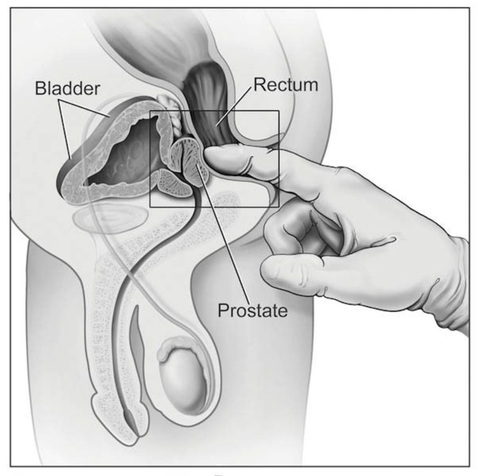 G Spot Diagram I Found My Mans G Spot And He Almost Lost It Xonecole